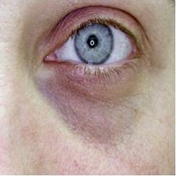 Suero renovador para ojos y rostro ~ Haz clic para seleccionar el aroma 